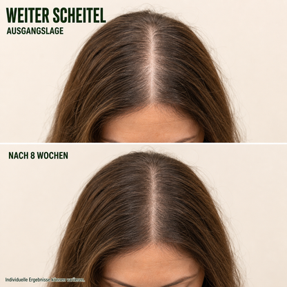 Koreanischer Kopfhaut-Revitalisierer