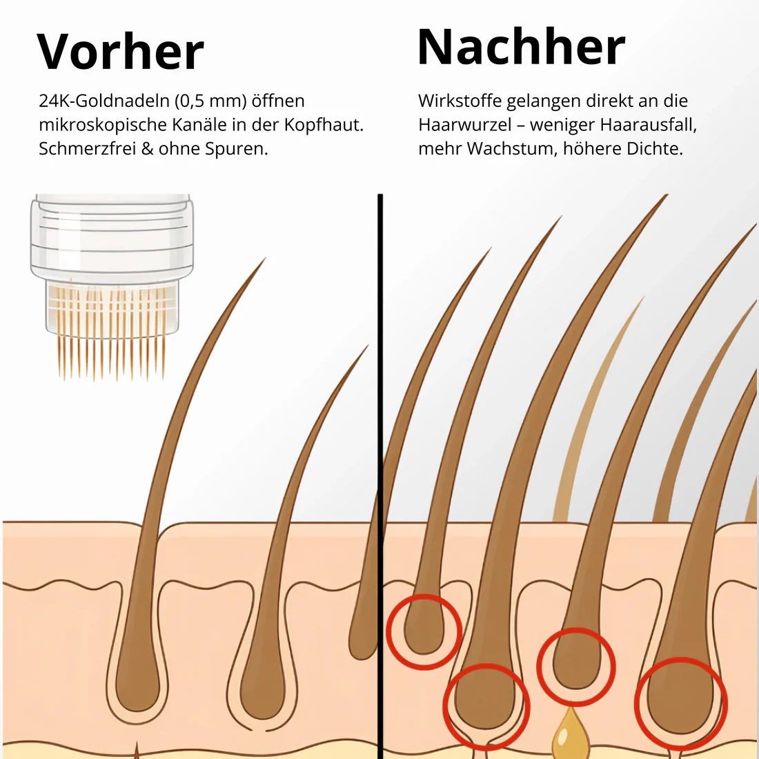 Avellio™ Haarwuchs System