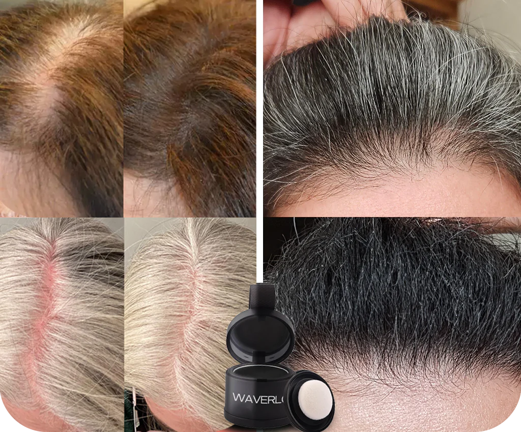 Avellio™ – Sofort Ansatz- & Grauhaar-Abdeckung
